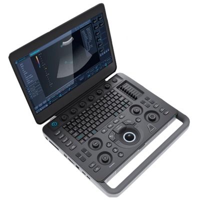 SonoScape S2N УЗИ сканер портативный